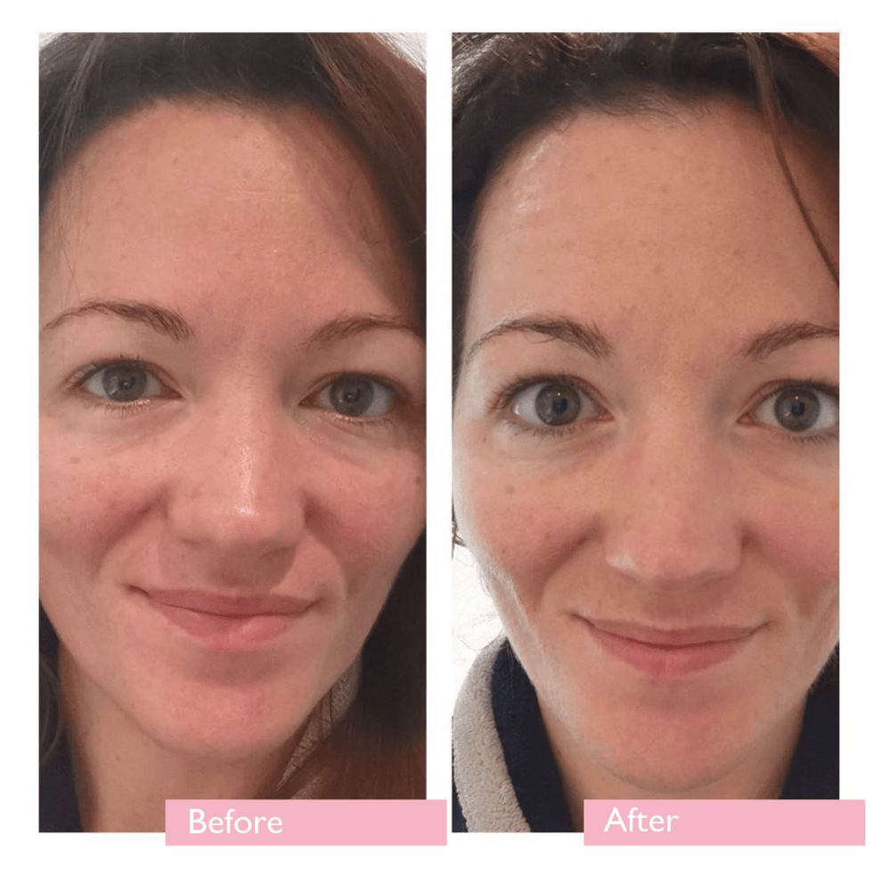 before and after photo of a woman using radiance eye gel